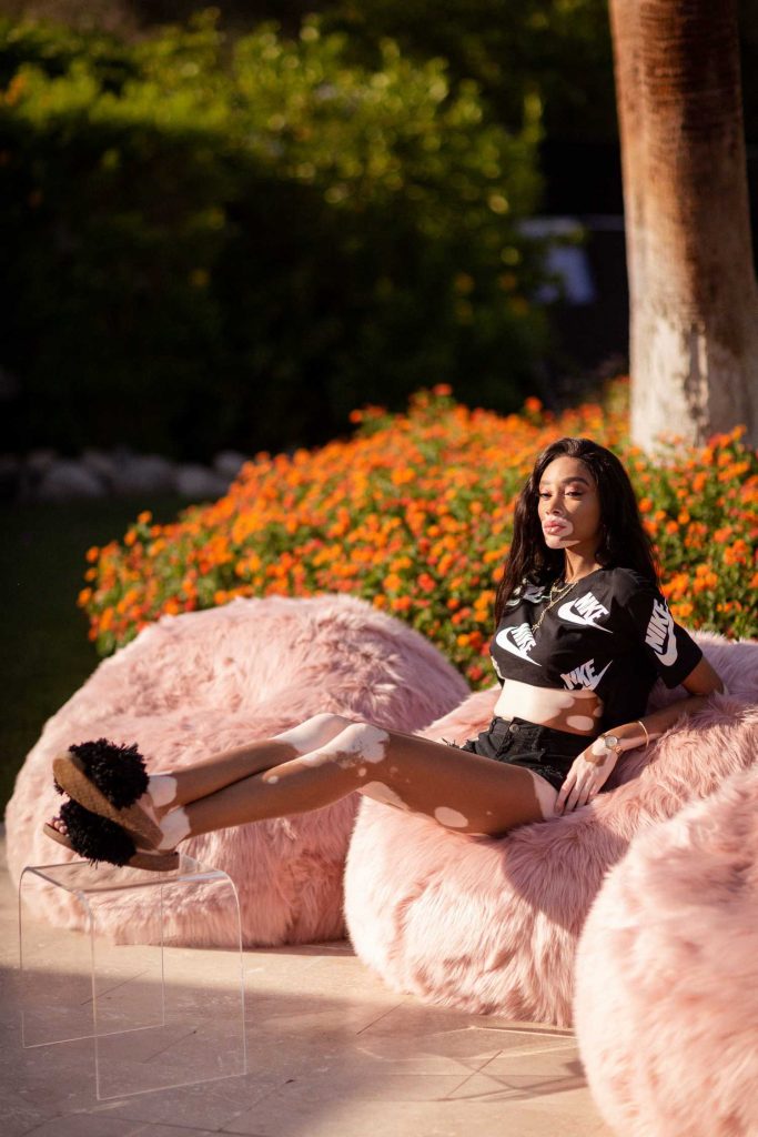 Winnie Harlow at the Ugg Collective Hosts Festival Kick-Off Brunch at Coachella Valley Music and Arts Festival in Indio-2