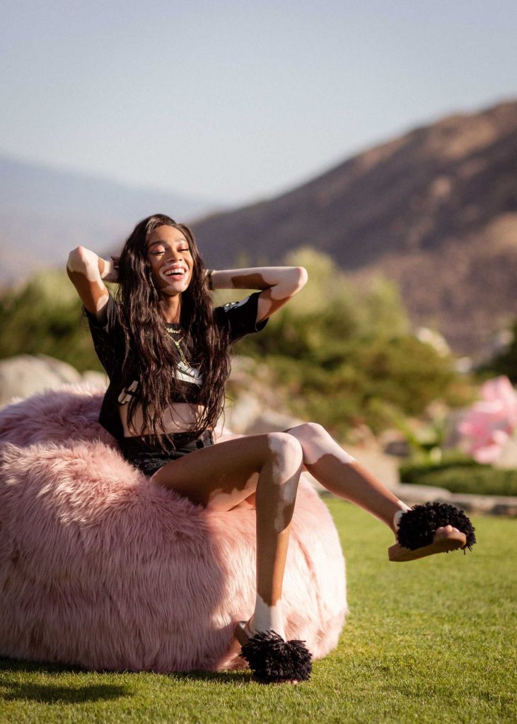 Winnie Harlow at the Ugg Collective Hosts Festival Kick-Off Brunch at Coachella Valley Music and Arts Festival in Indio-3